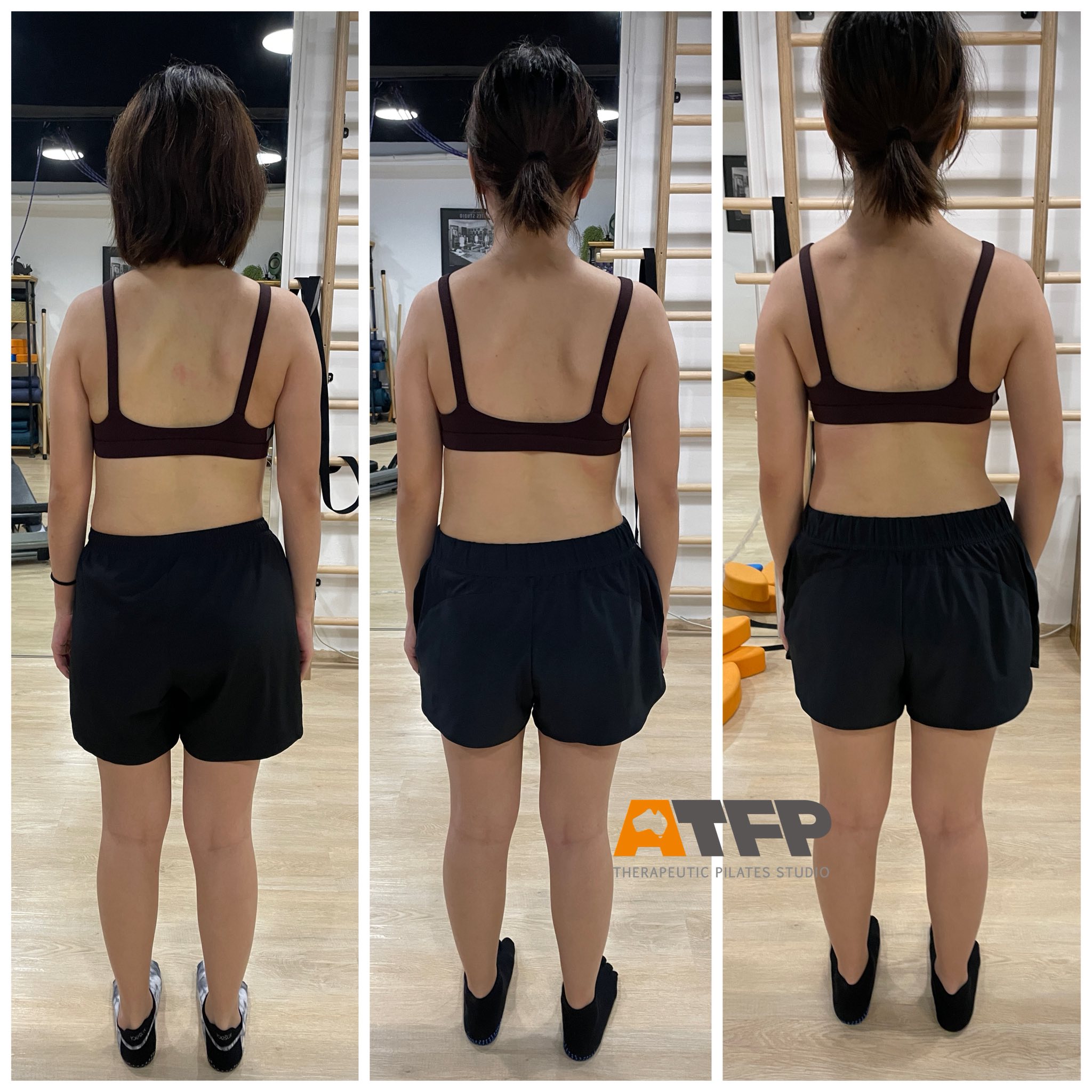 Certificate in Professional Survey for Posture Correction Instructor