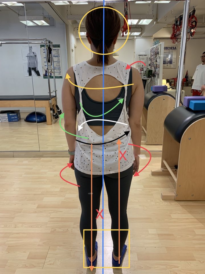 Certificate in Professional Survey for Posture Correction Instructor